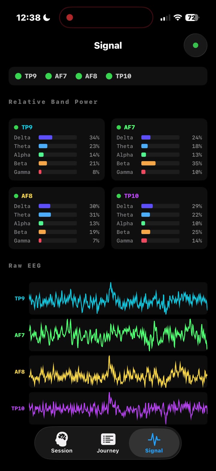Live brain signal