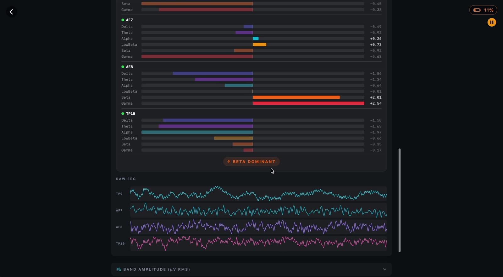 Live EEG data in the clinician app