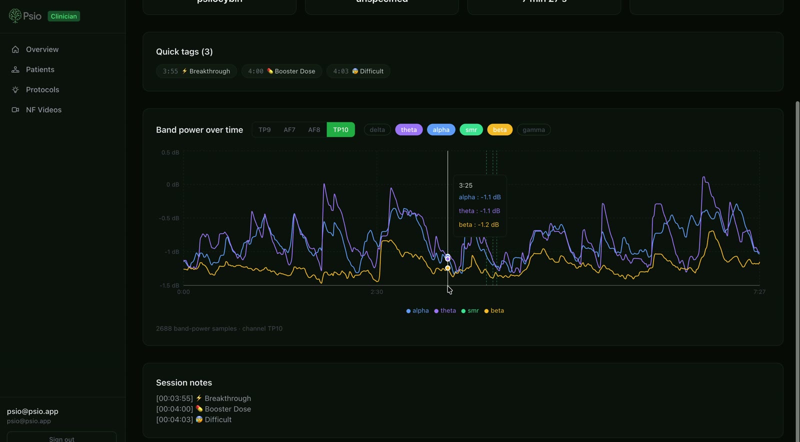 Session brain data in the clinic dashboard